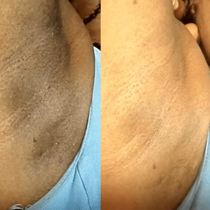 Antes e depois — paciente 1