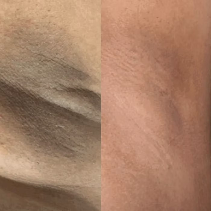 Antes e depois — paciente 2