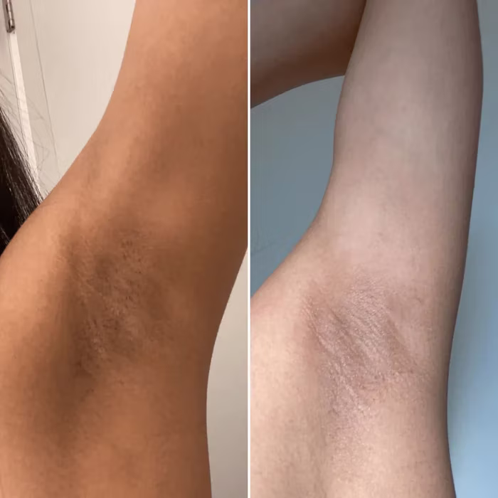 Antes e depois — paciente 3